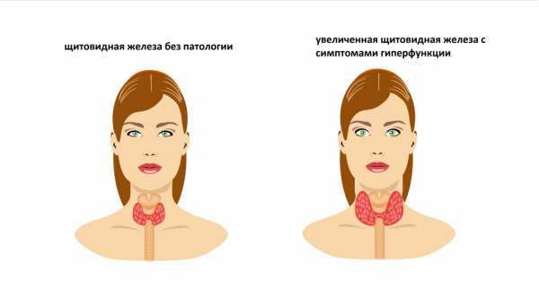 Нужно ли принимать йод для профилактики?